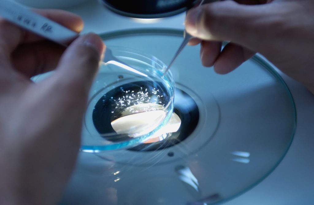 How Scientists Create Custom Antibodies for Research